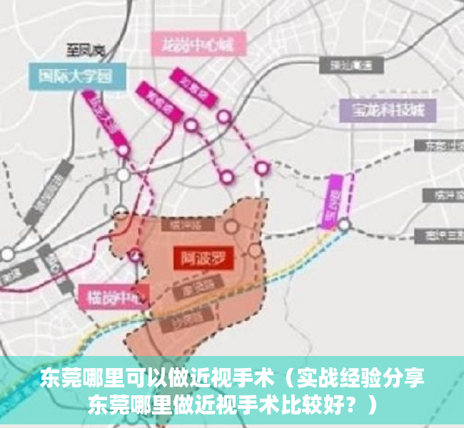 东莞哪里可以做近视手术（实战经验分享东莞哪里做近视手术比较好？）