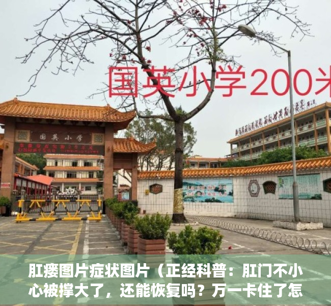 肛瘘图片症状图片（正经科普：肛门不小心被撑大了，还能恢复吗？万一卡住了怎么办？）
