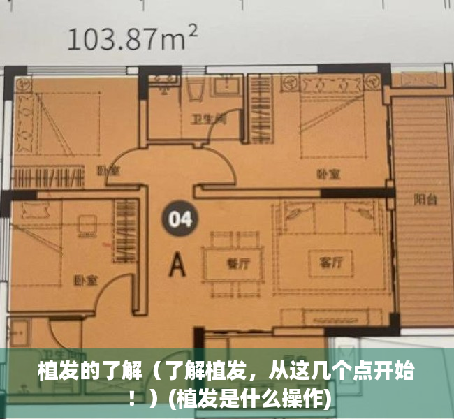 植发的了解（了解植发，从这几个点开始！）(植发是什么操作)